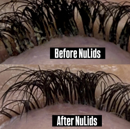 Eye Associates of New York | Orthokeratology, Glasses and Dry Eyes