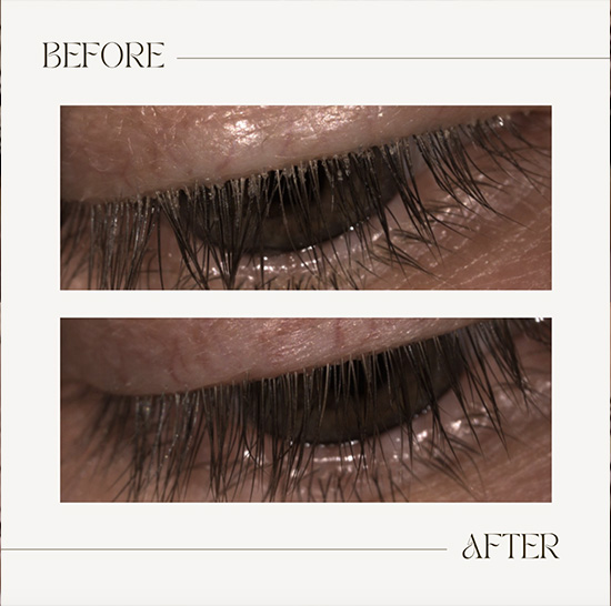 Eye Associates of New York | Color Vision Testing, LASIK Evaluations and Comprehensive Eye Exams