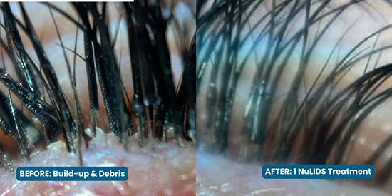 Eye Associates of New York | Glasses, Myopia Management and Contact Lenses